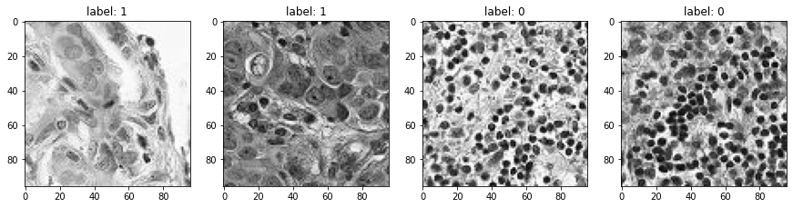 Example histopathological image data with cancer/no-cancer labels from the PatchCamelyon dataset.